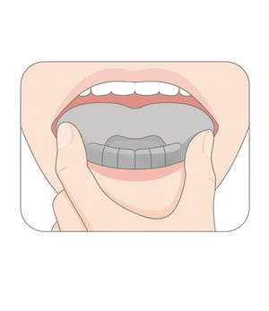 SnoreSealer Insertion to stop mouth breathing