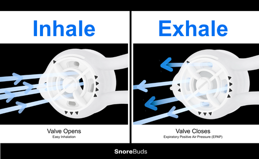 How EPAP Stops Snoring