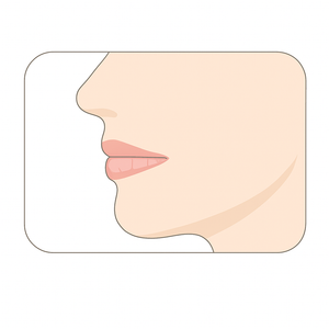 SnoreSealer for lip seal and stopping mouth breathing