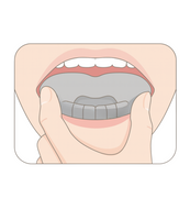 SnoreSealer Insertion to stop mouth breathing